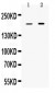 Anti-Periplakin Picoband Antibody